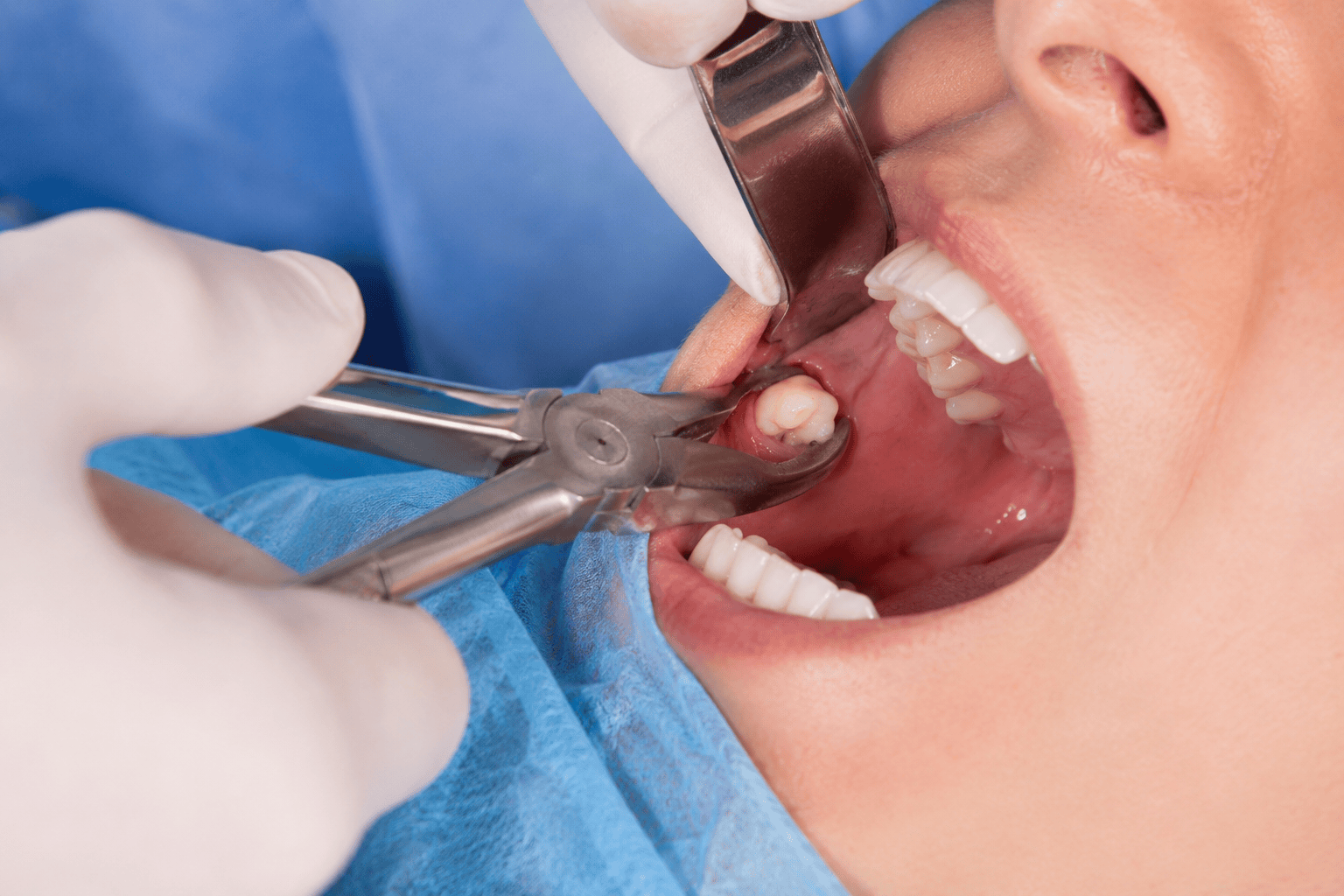 VP Dental Clinic Dental Oral Surgery Services